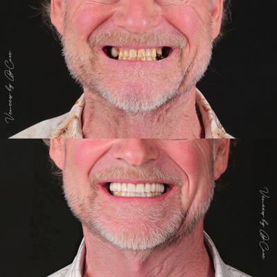 Slider image (1) Dr. Care Implant Clinic